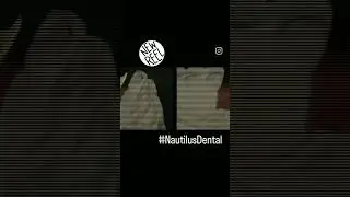 emax custom abutment