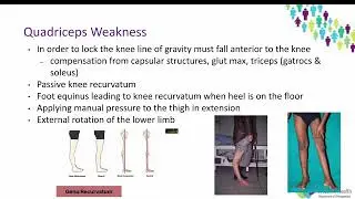 OrthoFracs - Orthopaedic Manifestations of Poliomyelitis by Dr. Phoebe Walker