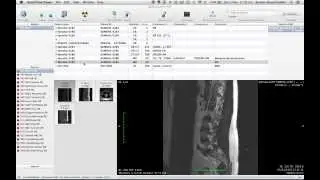 Tutorial 021 OsiriX  How to Edit Series Number