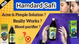 Pimples Gone ? | Natural Blood Purifier? | Hamdard Safi Truth Revealed !