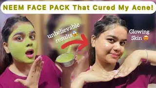 DIY Neem🌿Face Pack for Acne | Get Clear✨& Glowing Skin | Shocking Results | Secret Revealed😍| #acne