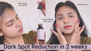 How to reduce Dark spots? What is Dark spots? How we get Dark spots ? All questions answered