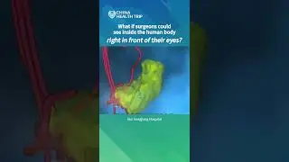 With Surgical AR, Today's Chinese Surgeons Are Like Drivers With GPS🧭 #vr  #technology  #medical