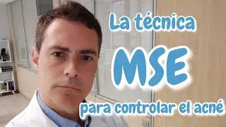 Dermatólogo explica la técnica MSE para control del acné