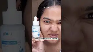 I applied niacinamide serum for 7 days #trendingonshorts #challenge