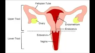 Reproduction tract infections; affect the reproductive organs, by bacteria, viruses, or parasites