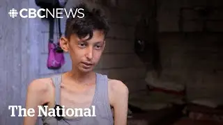 Gaza teen explains what it&rsquo;s like to starve