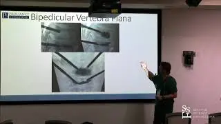 Vertebral Augmentation; Pedicular Approach - Neal H  Shonnard, MD