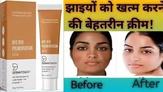Darmatouch Bye Bye Pigmentation Cream 💖 !! Working Or Not #Darmatouch #Bestpigmentationcream