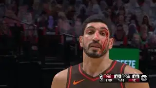 Enes Kanter GETS STITCHES After SCARY BLOODY INJURY To His Face | NBA 76ers vs. Trailblazers | Feb