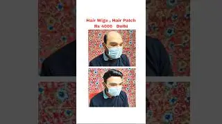 Delhi Hair Wigs Price List | 9990115900 | Hair Wigs In Delhi Near Me
