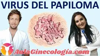 DUDAS SOBRE EL VPH (VIRUS DEL PAPILOMA HUMANO): DUDAS CON LA DRA. DIANA ÁLVAREZ.