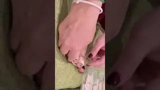 How to use Toe Wraps to correct bending, curving, curling, crookedness, and overlapping toes?