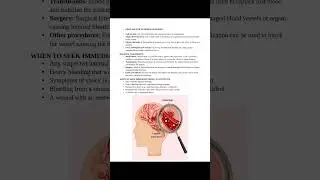 Hemorrhage#physicianassistant#health#medicalcondition#trendingwithmedico#yoitubeshorts#brain#nursing