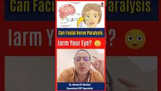 Facial Nerve Paralysis & Nighttime Eye Damage ⚠️ Don&rsquo;t Ignore This! | ProHealthConsults #shorts