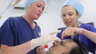 UltraPulse Co2 Laser Live Treatment at 152 Harley Street - APV Film