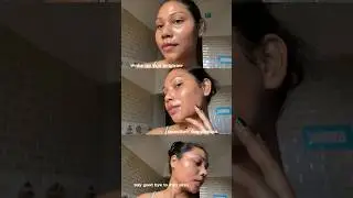 Dermdoc 2% kojic acid night cream || get a glowing skin while you sleep 😴