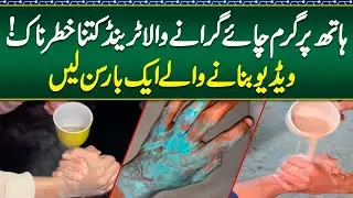 Chai Girany Wala Trend Kitna Khatarnaak! Video Banany Waly 1 Bar Sun Lyn - Hath Jal Jaye To Kya Kare