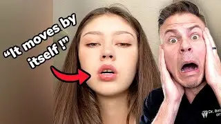 Orthodontist Reacts! Crazy Talking Teeth!