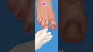 ASMR animtion foot nail treatment #asmr #satisfying #short #video #trending #2023 #asmr nail