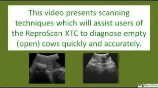 Scanning the Empty (Open) Uterus with a ReproScan 4.0 MHz Convex Probe
