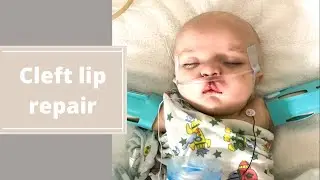 CLEFT LIP REPAIR- Basic surgery and recovery information
