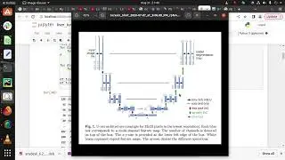 Classification & Segmentation of Liver Tumor|  3D-UNET | PyTorch  |+91-7973788405 for query