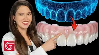 Mill Service for Full-Arch Implant