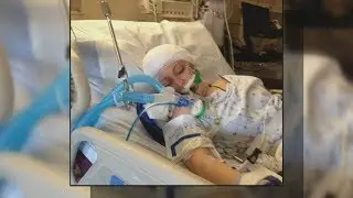 Japp's manager recovering from serious head injury after parking lot assault