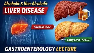 Alcoholic & Non-Alcoholic Liver Disease | Gastroenterology Full Lecture | Liver Disorders Explained