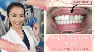 How to treat a discolored or dark tooth ? (zirconia crown)