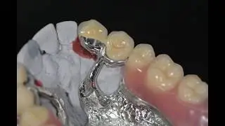 STELLITE AVEC ATTACHEMENTS