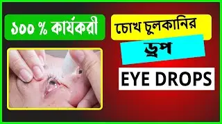 চোখ চুলকানির ড্রপ (Alarid Eye drop)  সঠিক ব্যবহার ও সতর্কতা জেনে নিন!