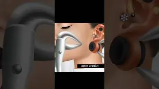ear satisfying treatment asmr #shorts