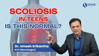Scoliosis Explained: Early Signs, Tests & Modern Treatment Options #DrUmesh #Bangalore #Spine360
