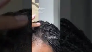 Blueberry Bliss Mint Tea Scalp Treatment 💙
