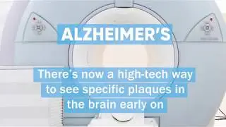 3 Things About Alzheimer's Right Now