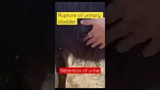 Rupture of urinary bladder l Dr Umar Khan