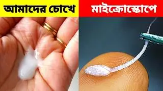 Which can only be seen under a microscope. 😳 5 Things You Can Only See Under a Microscope bangla ...