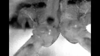 Interacting Gears Synchronize Propulsive Leg Movements in a Jumping Insect