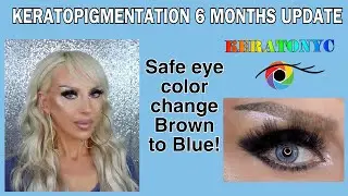 EYE COLOR CHANGE 6 MONTHS UPDATE, KERATOPIGMENTATION FRENCH BLUE MEDIUM INTENSITY