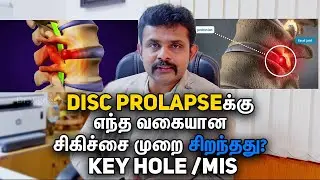 Which Type of Disc Prolapse Needs Intervention ( key&nbsp;hole/&nbsp;MIS) Dr. Vignesh Pushparaj