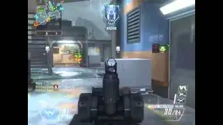 Scar-H Quad on saw utero