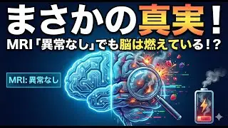 【MSの正体】「MRIは異常なし」でも不調な理由。くすぶり型MSと脳を守る新常識