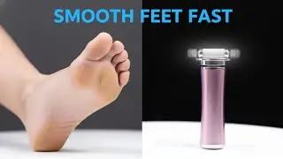 Say Goodbye to Cracked Heels! 🛑 How to Fix Dry Feet Fast