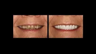 Calm Your Dental Anxiety with Dr. Steven Gorman