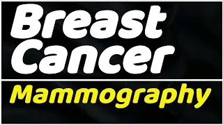 How Mammography Works: A Guide to Breast Cancer Screening