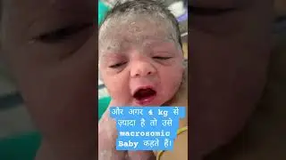 Normal weight of New born baby | low birth weight baby | macrosomic baby #lowbirthweight