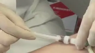 Забор крови для анализа на газы крови