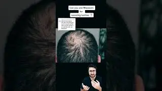 Can you use Maxzoom for receding HAIR line ❓
